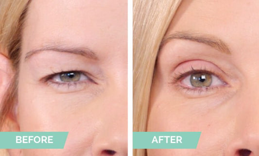 Natural Invisible Eyelid (90 Strips)