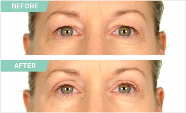 Natural Invisible Eyelid (90 Strips)